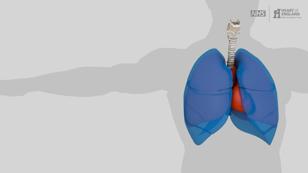 6_Pleural_Biopsy_Talc 2